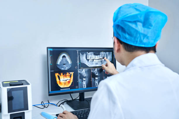 Best Knocked-Out Tooth (Avulsed Tooth) Treatment in Pinebluff, NC